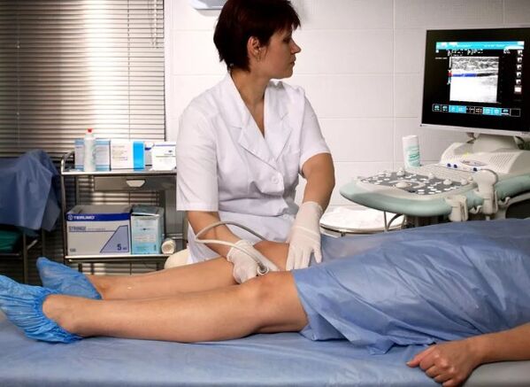 Diagnosing varicose veins in the lower limbs
