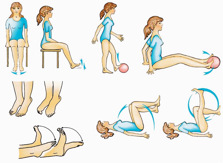 Physical exercise for varicose veins